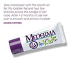 Mederma For Kids Skin Care for Scars, 20 Gram